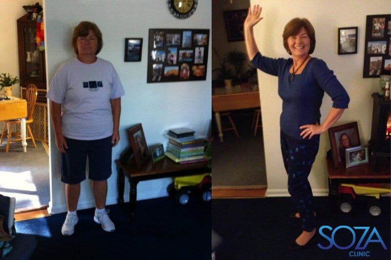 Soza Clinic patient before and after, photo 29