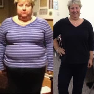 Soza Clinic patient before and after, photo 30