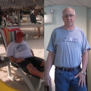 Soza Clinic patient before and after, photo 32
