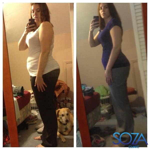 Soza Clinic patient before and after, photo 40