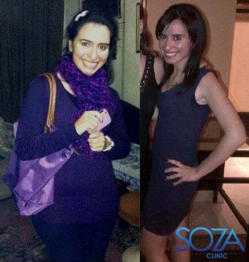 Soza Clinic patient before and after, photo 6