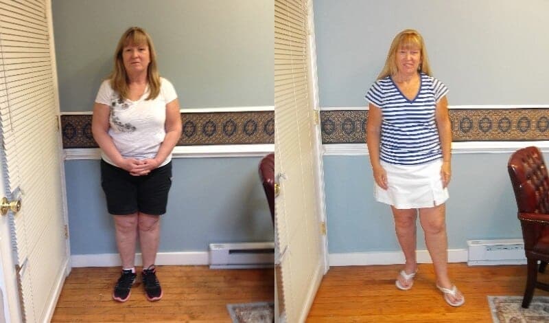 Soza Clinic patient before and after, photo 9