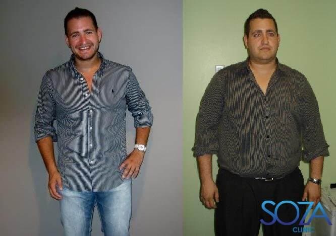 Soza Clinic patient before and after, photo 24