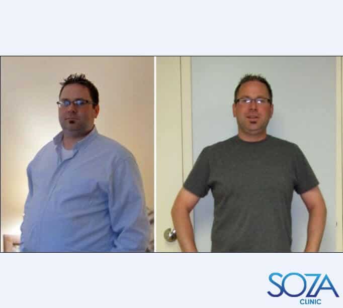 Soza Clinic patient before and after, photo 12