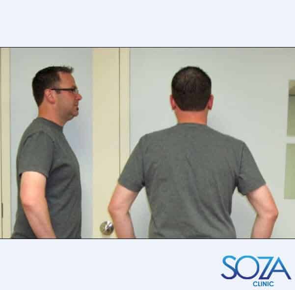 Soza Clinic patient before and after, photo 13