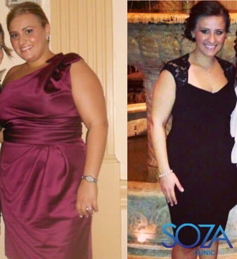 Soza Clinic patient before and after, photo 14
