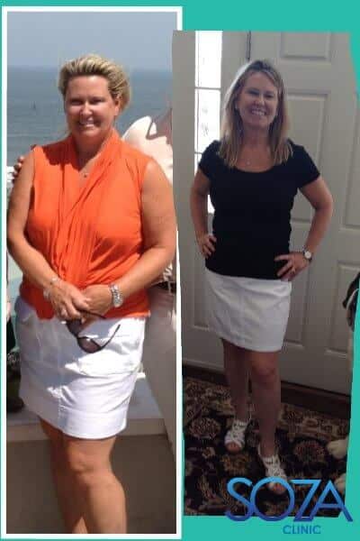 Soza Clinic patient before and after, photo 17