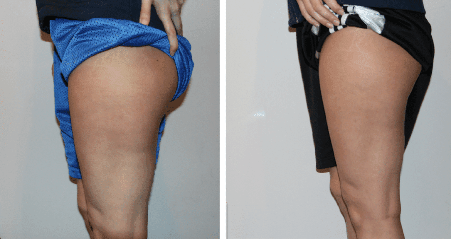 Soza Clinic patient before and after, photo 3