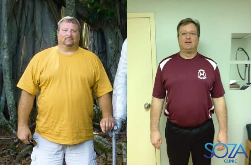Soza Clinic patient before and after, photo 21