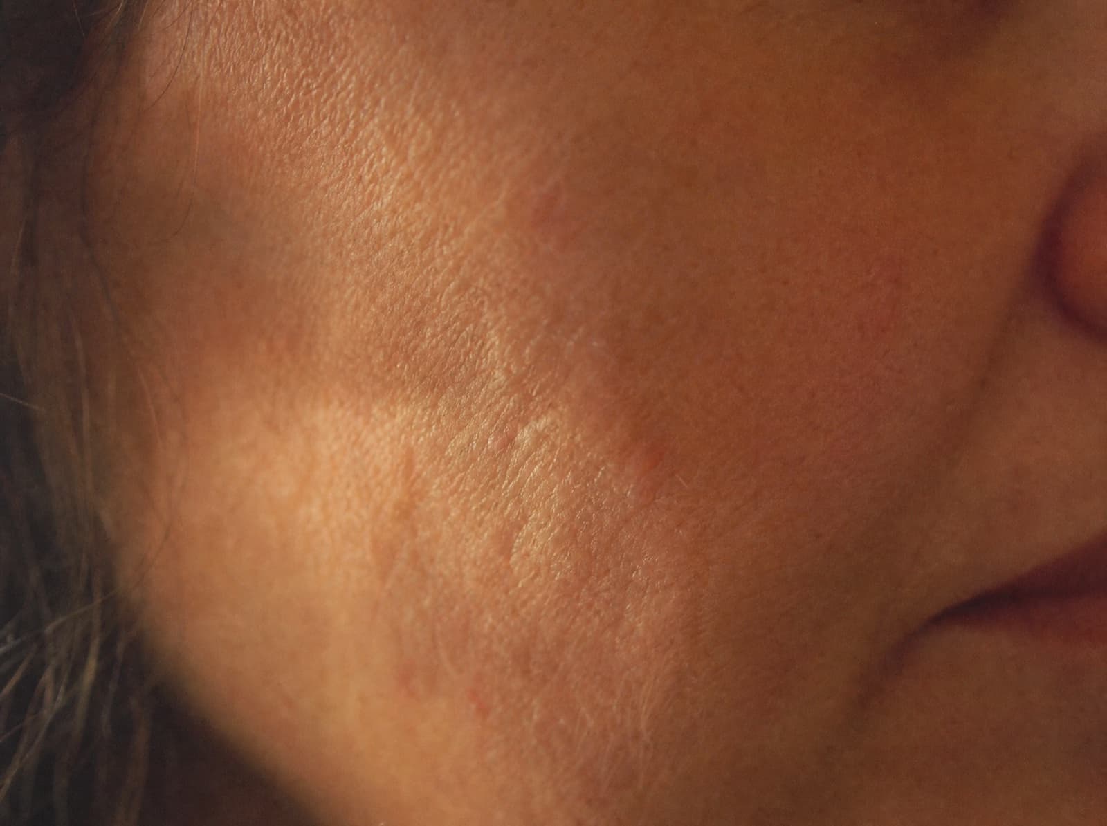 A macro study of natural mature skin texture