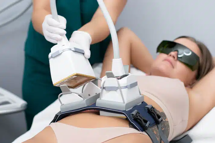 Venus Bliss diode laser applicators positioned on a patient's abdomen during treatment